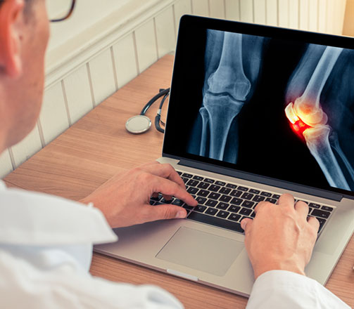 Orthopedic Surgery Second Opinion