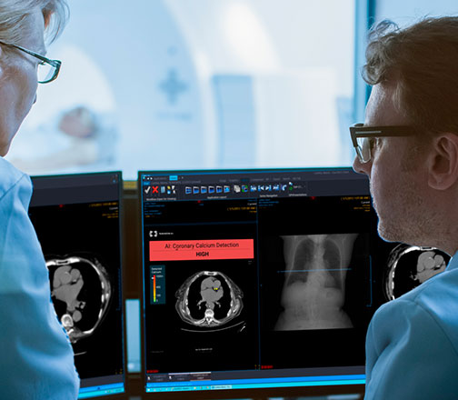 Harnessing AI for Second Opinions: help identify early signs related to cardiovascular disease